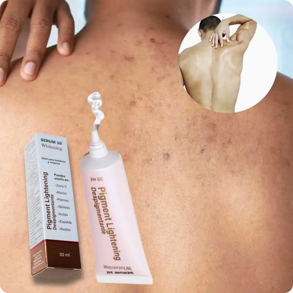 CREMA DESPIGMENTANTE Y ACLARANTE PARA HOMBRES