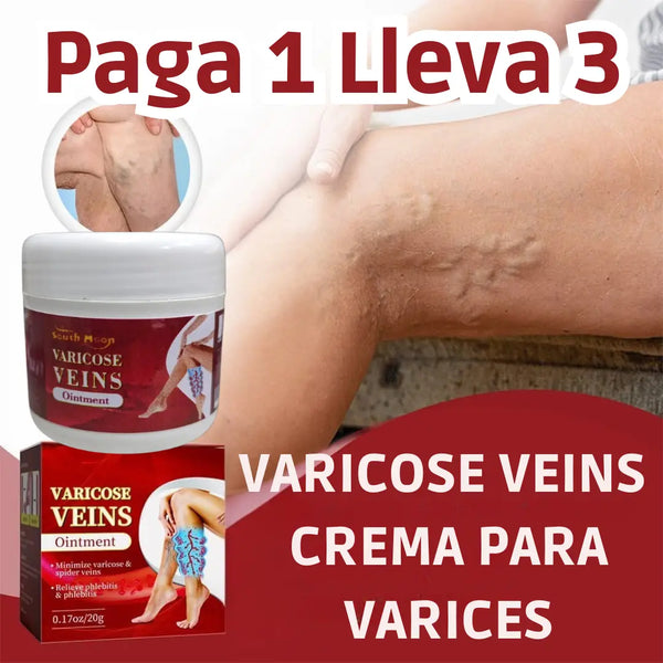 VARICOSE VEINS CREMA PARA VARICES
