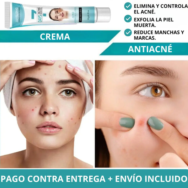 CREMA ANTIACNÉ ¡RESULTADOS GARANTIZADOS!