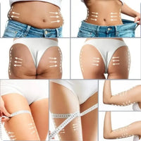 CREMA ANTI ESTRIAS SKIN REPAIR®