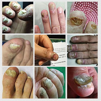 TRATAMIENTO PARA UÑAS ® ¡GRAN PROMOCIÓN!