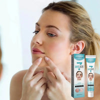 CREMA ANTIACNÉ ¡RESULTADOS GARANTIZADOS!