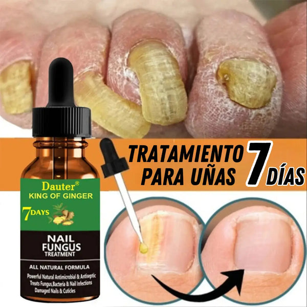 TRATAMIENTO PARA UÑAS ® ¡GRAN PROMOCIÓN!